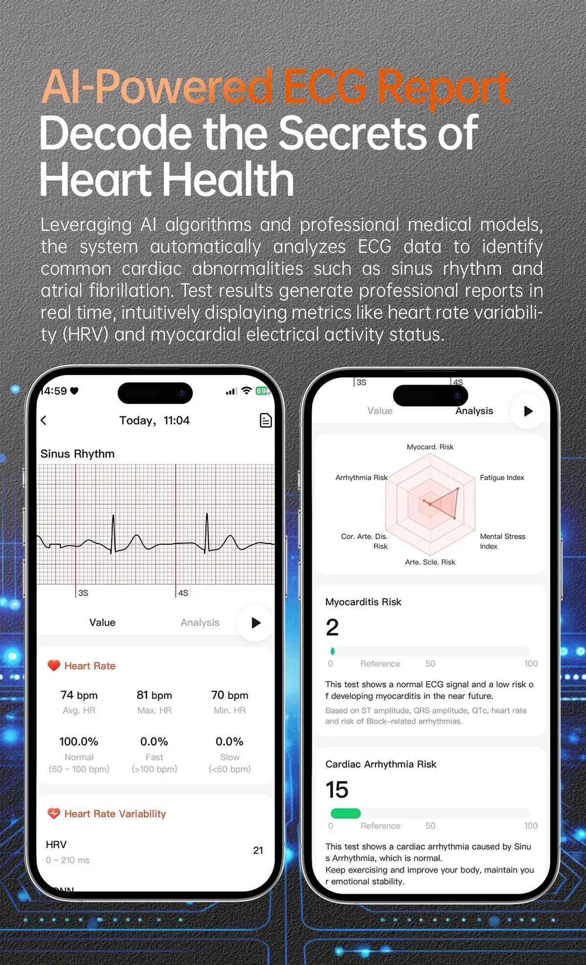 XIAOMI 704505 New ECG+PPG Smartwatch Precise Uric Acid Blood Lipids Pressure Body Analysis Smart Watch Men BT Call NFC Watches