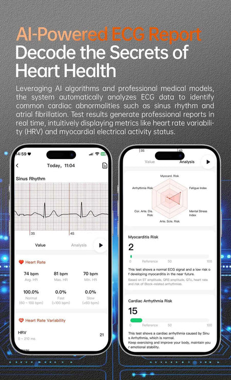 XIAOMI 704505 New ECG+PPG Smartwatch Precise Uric Acid Blood Lipids Pressure Body Analysis Smart Watch Men BT Call NFC Watches